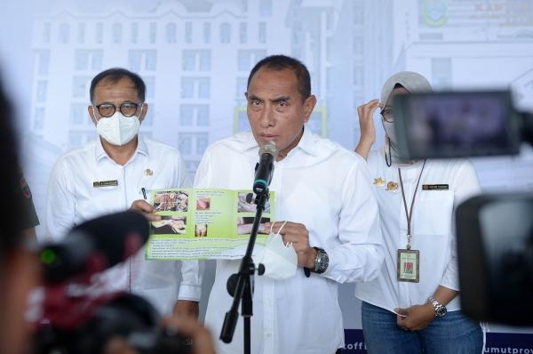 Pengendalian Wabah PMK di Sumut, Gubernur Edy Rahmayadi Lakukan Tiga Langkah Antisipasi